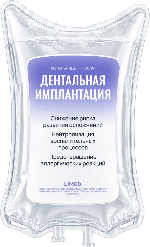 Дентальная имплантация ПОСЛЕ